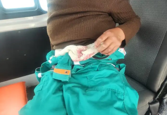 Trabajadora de La Paz Limpia es herida de balín en el estómago