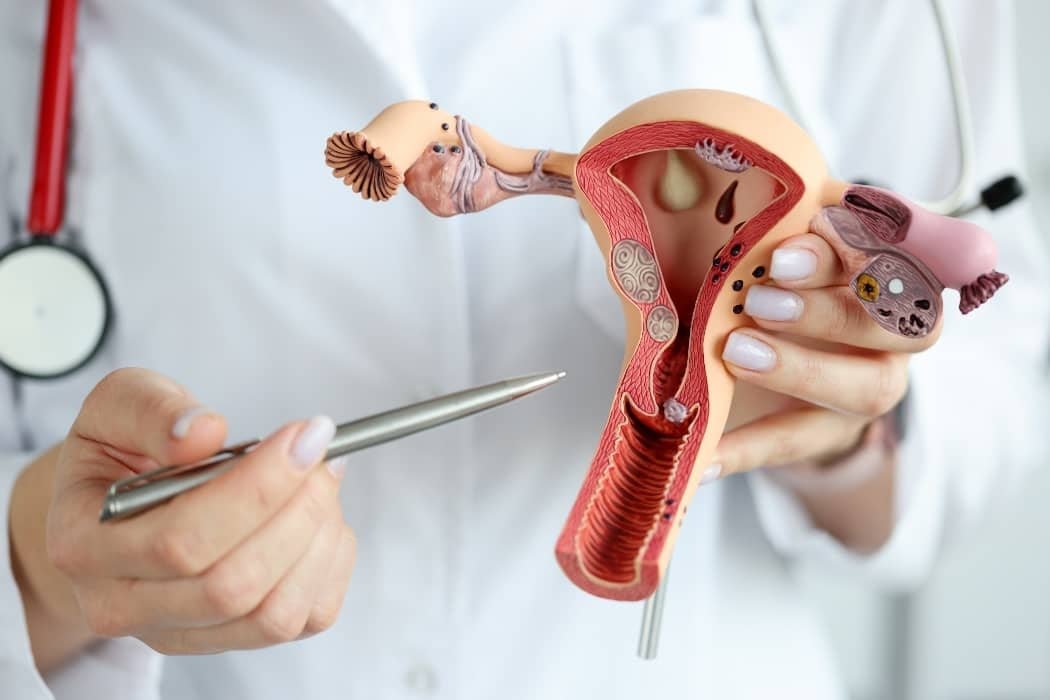 Cáncer de Cuello Uterino