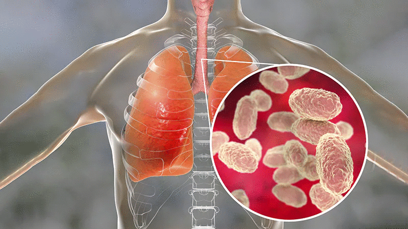 Alerta en Santa Cruz: Muere otro niño por coqueluche y piden vacunar a los menores