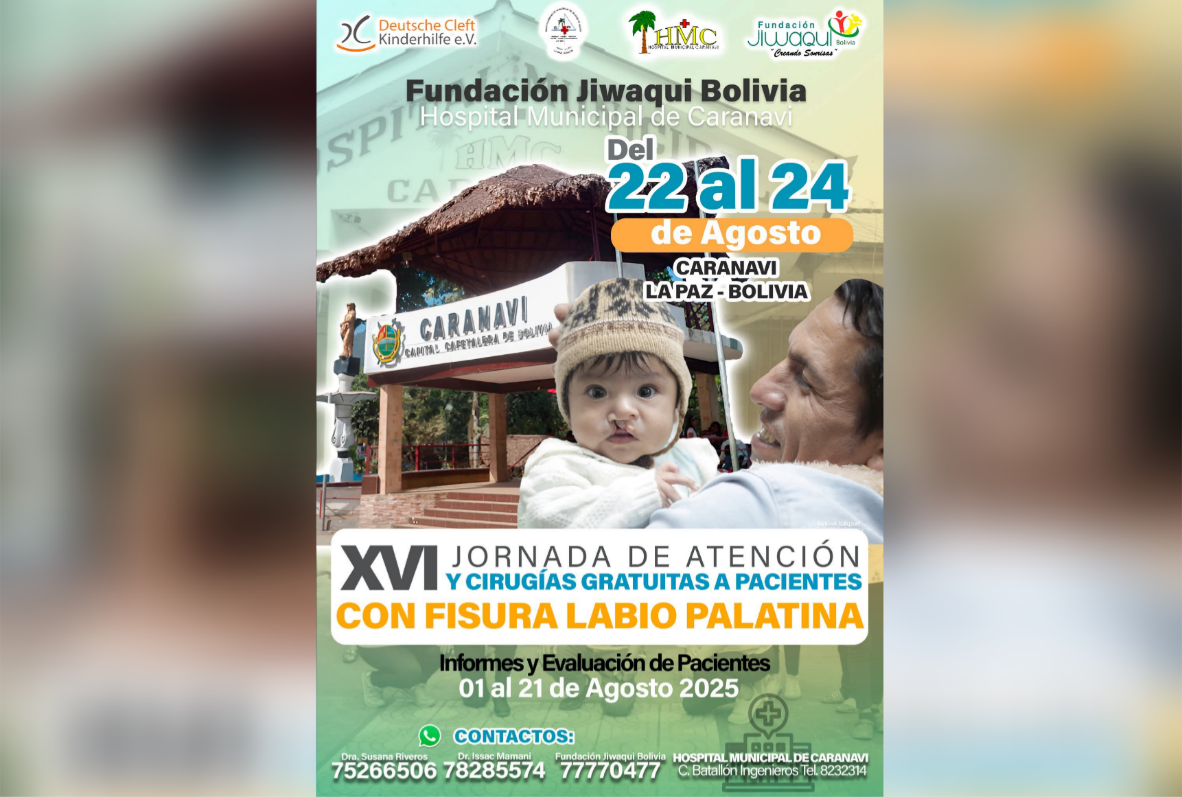 Jornada gratuita de cirugías para pacientes con fisura labio palatina en Caranavi