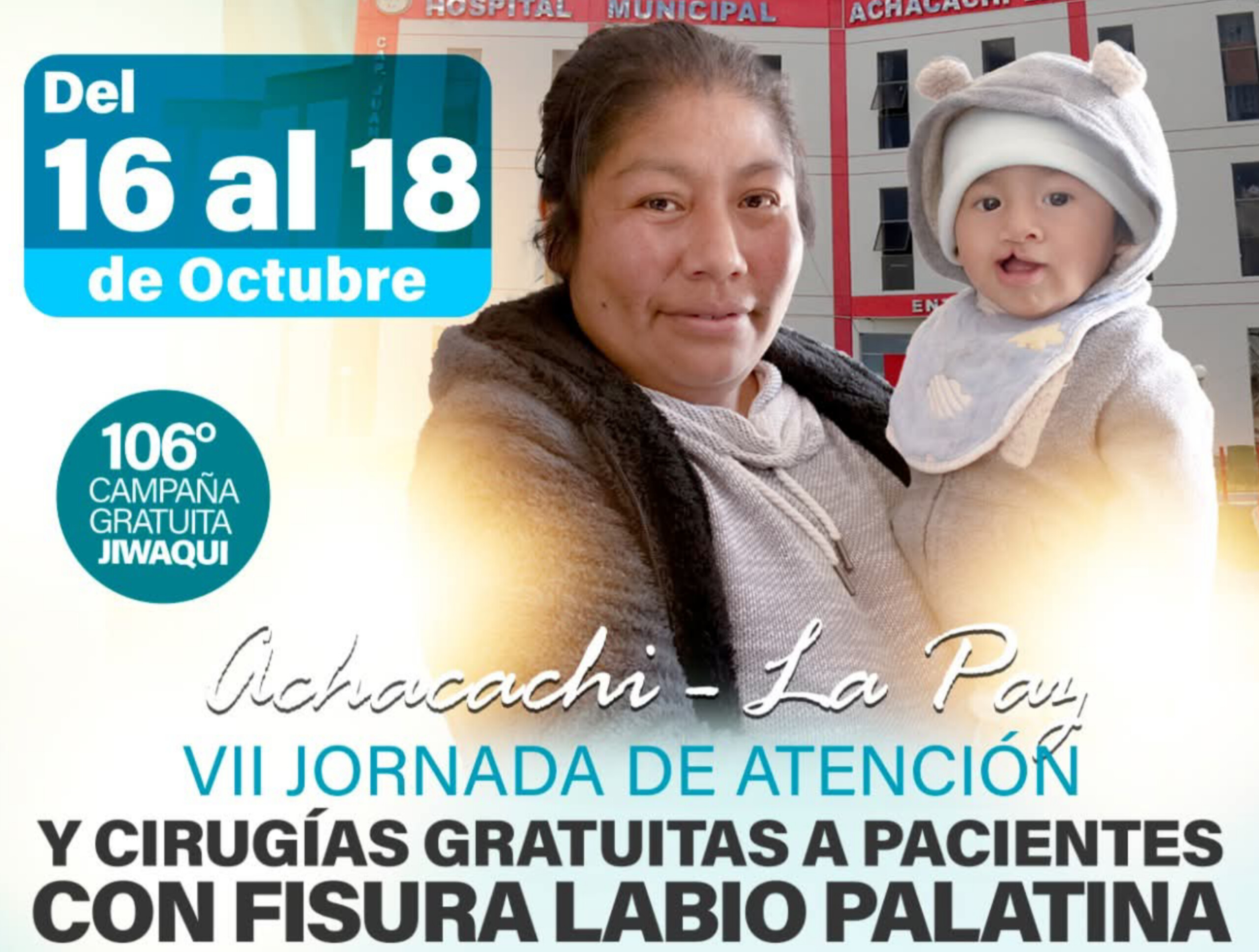 Labio platina Achacachi